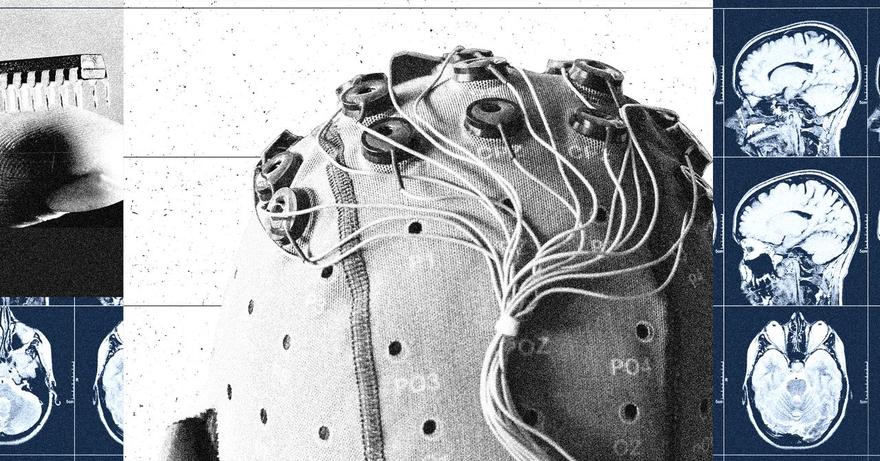 China built in the brain interface industry