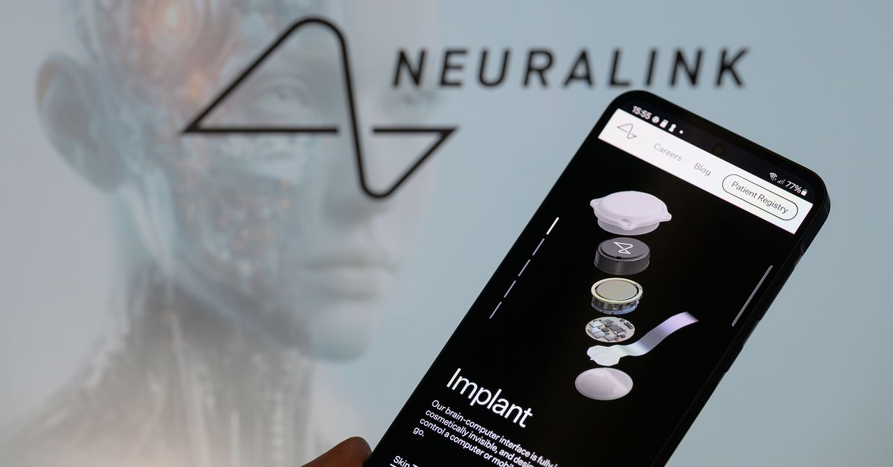 Neuralink's offer to the brand's "telepathy" and "telekinesis" faces legal insugers